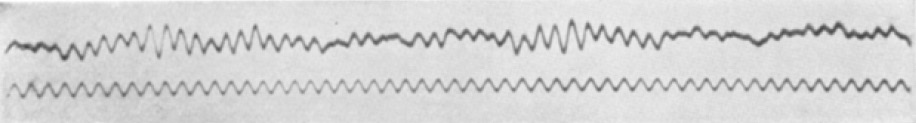 A narrow strip of paper carrying a long wavy hand-drawn line: the first published human EEG trace