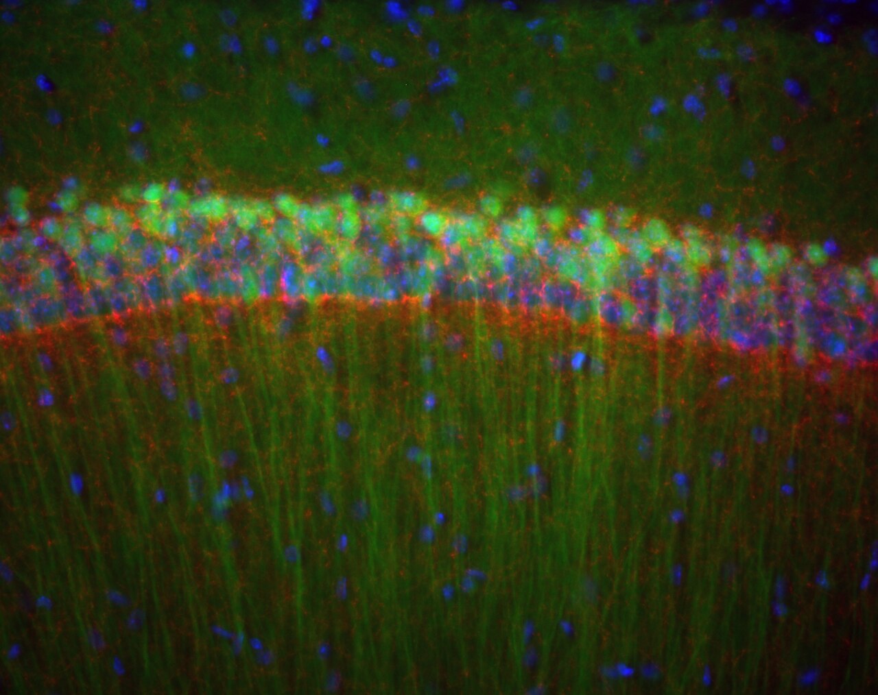A microscope image of brain tissue, showing a dense dark band of tightly packed nerve cell bodies curving across a paler background