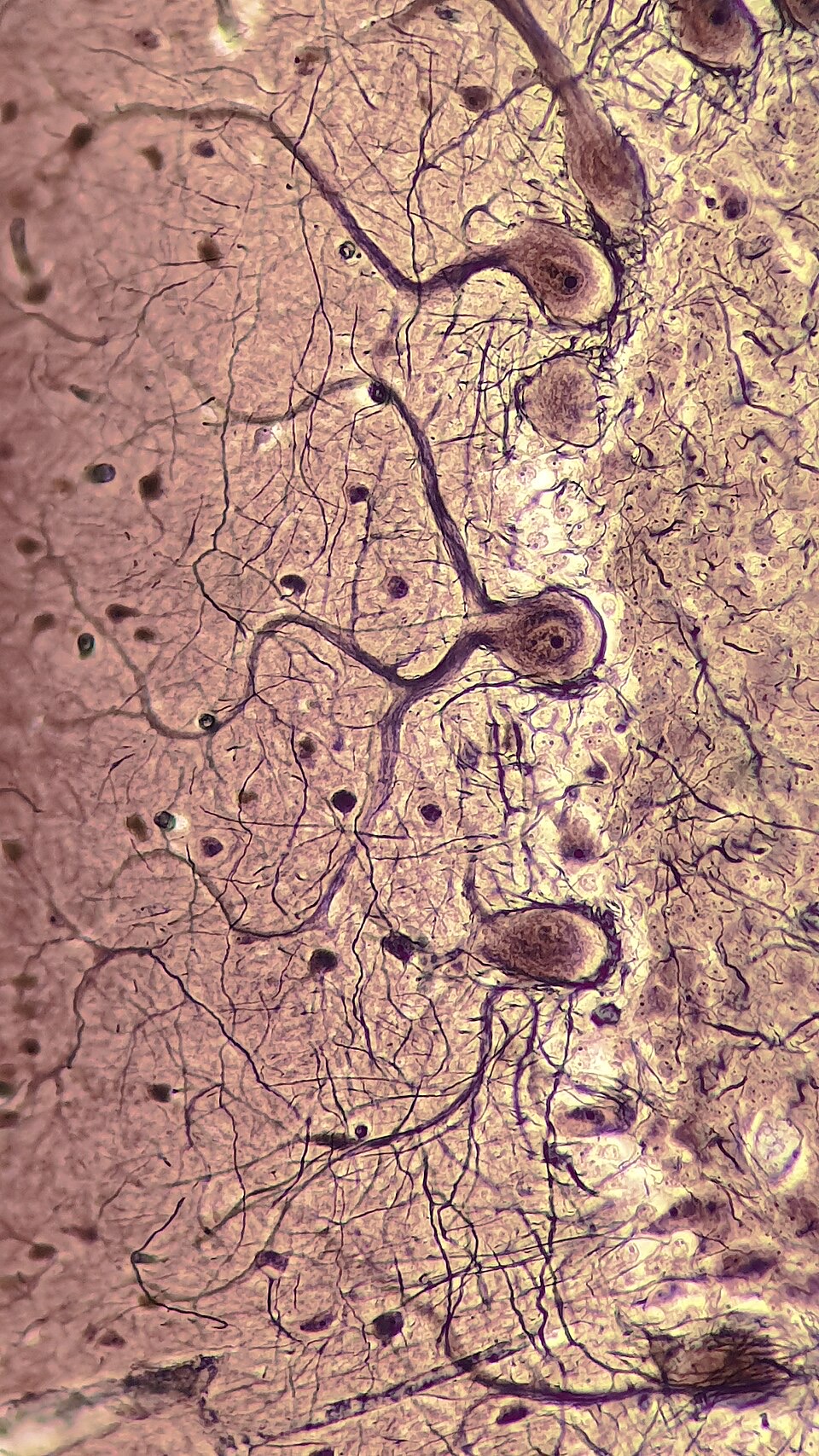 A microscope image of large branching nerve cells stained dark against a pale pink background