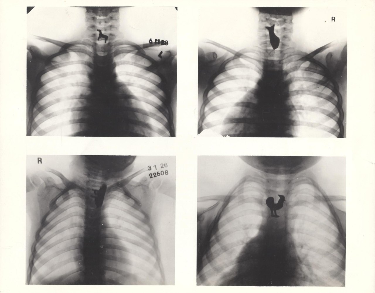 Four black-and-white chest X-rays of children arranged in a grid; in each, a small dark toy-shaped object, including a tiny dog and a rooster, shows up sharply in the throat or chest