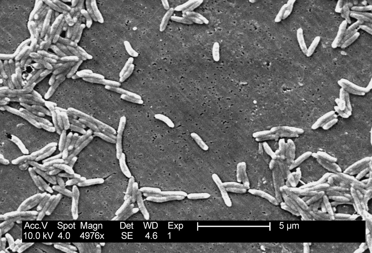 A black-and-white electron microscope image of dozens of small rod-shaped and curved bacteria scattered across a rough gray surface, with a scale bar reading five micrometers
